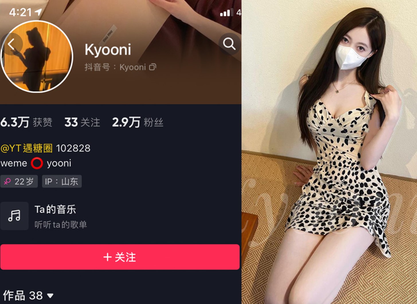 Yooni有你喵/Kyooni—微密付费视频图片合集【持续更新】